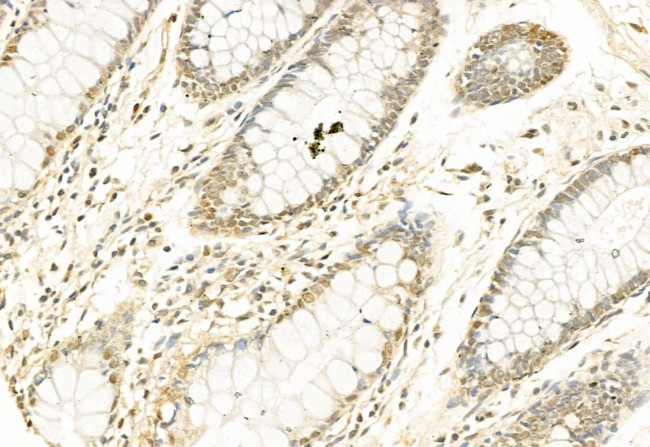 SNAIL Antibody in Immunohistochemistry (Paraffin) (IHC (P))