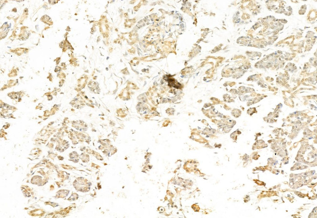 SNAIL Antibody in Immunohistochemistry (Paraffin) (IHC (P))