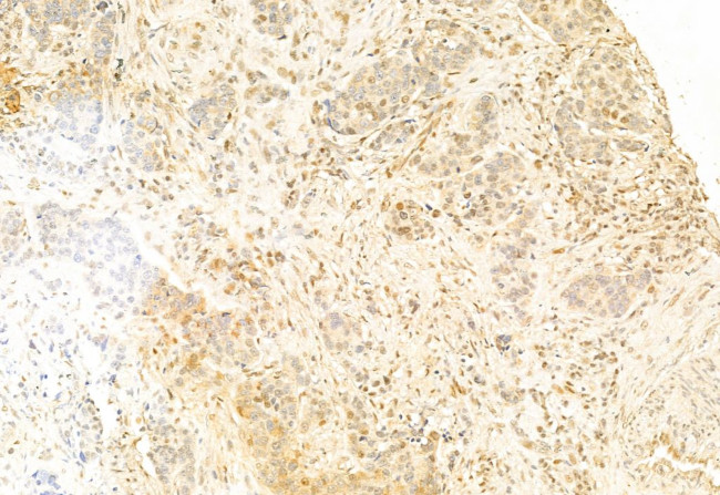 SNAIL Antibody in Immunohistochemistry (Paraffin) (IHC (P))