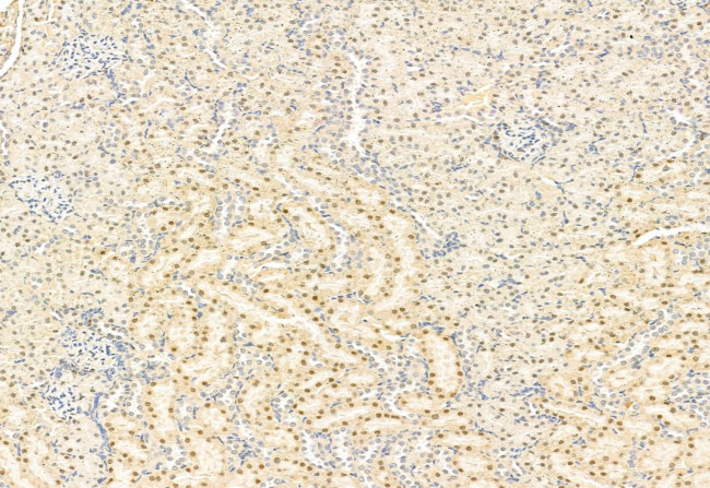 SNAIL Antibody in Immunohistochemistry (Paraffin) (IHC (P))