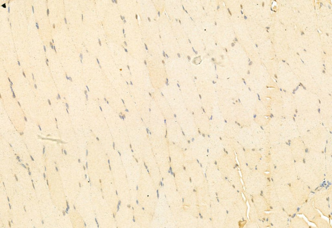 SNAIL Antibody in Immunohistochemistry (Paraffin) (IHC (P))