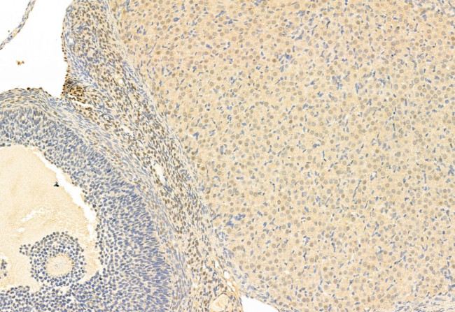 SNAIL Antibody in Immunohistochemistry (Paraffin) (IHC (P))