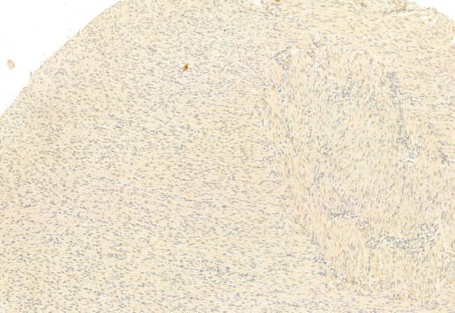 SNAIL Antibody in Immunohistochemistry (Paraffin) (IHC (P))