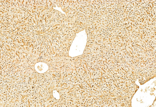 SNAIL Antibody in Immunohistochemistry (Paraffin) (IHC (P))