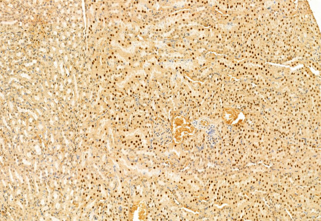 SNAIL Antibody in Immunohistochemistry (Paraffin) (IHC (P))