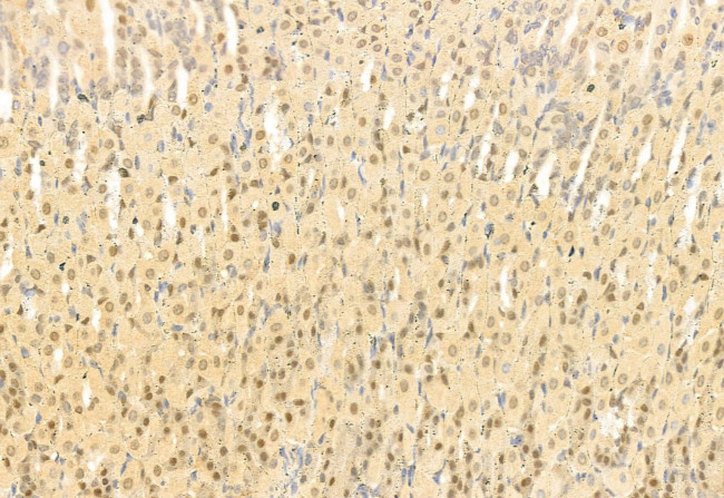 SNAIL Antibody in Immunohistochemistry (Paraffin) (IHC (P))