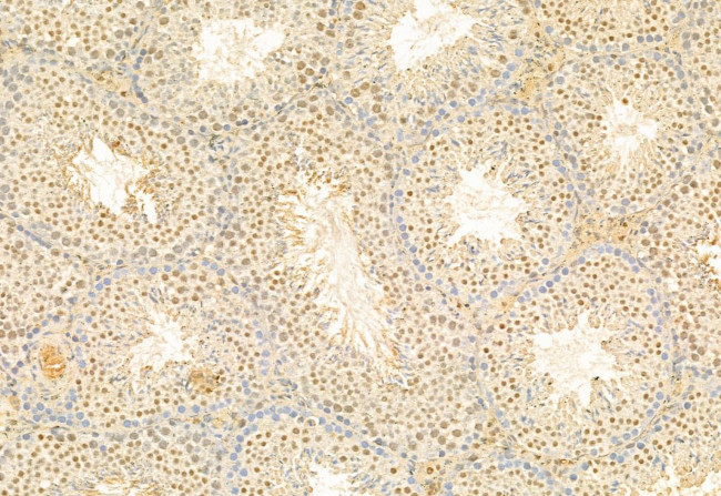 SNAIL Antibody in Immunohistochemistry (Paraffin) (IHC (P))