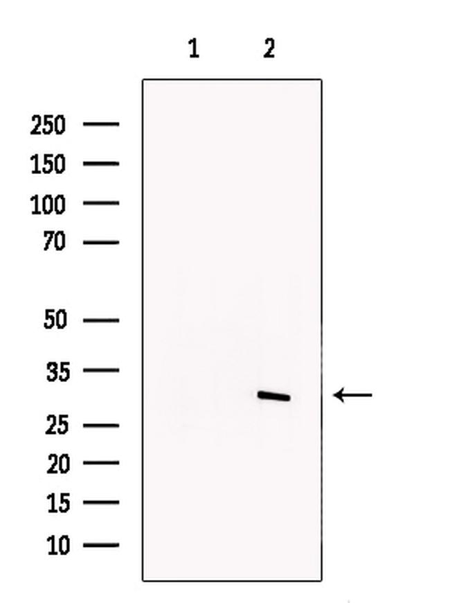 SNAIL Antibody in Western Blot (WB)