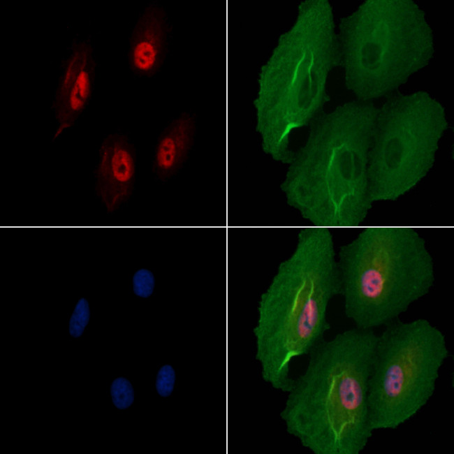 SNRNP70 Antibody in Immunocytochemistry (ICC/IF)