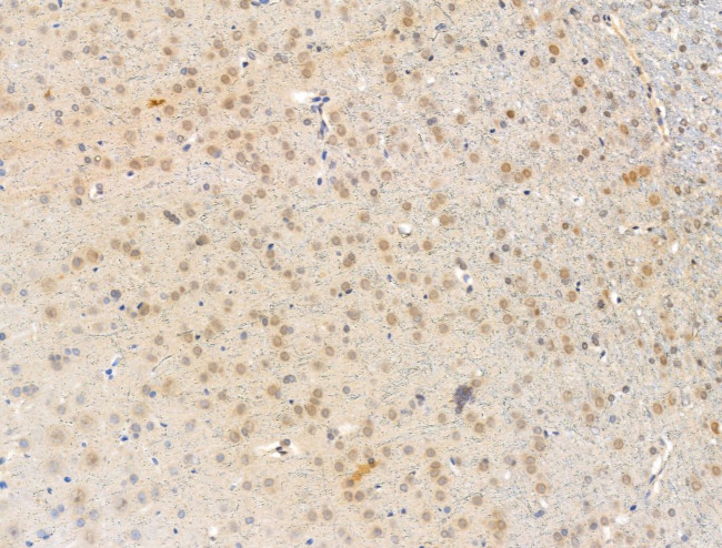 SNRNP70 Antibody in Immunohistochemistry (Paraffin) (IHC (P))