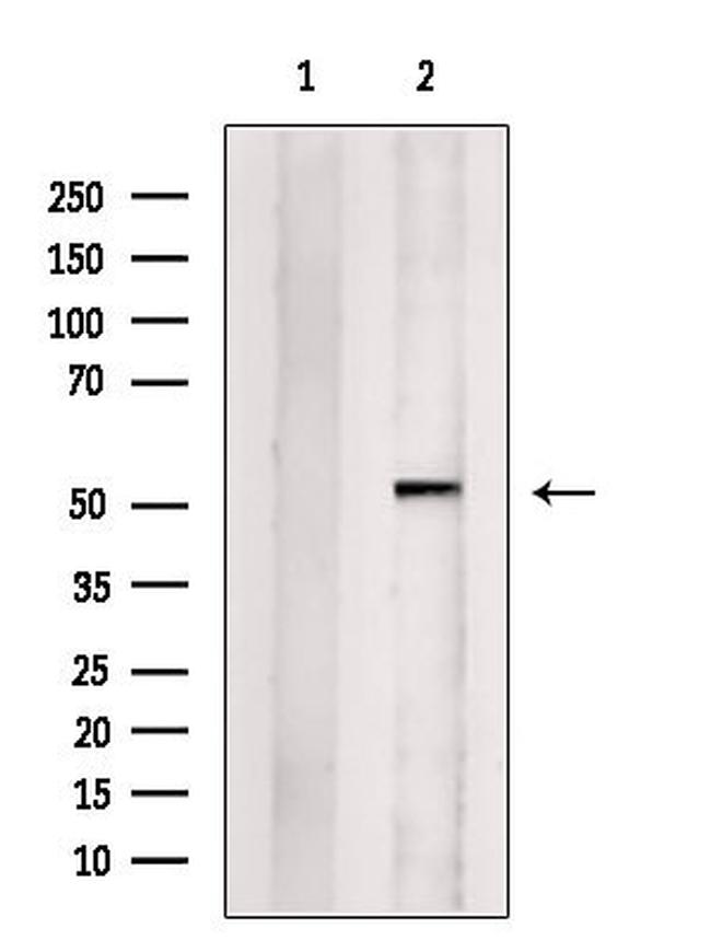 SNRNP70 Antibody in Western Blot (WB)