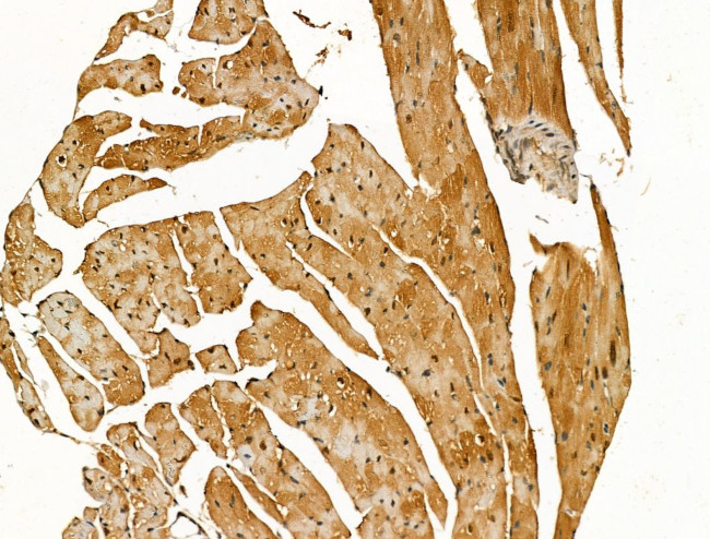 SNTB2 Antibody in Immunohistochemistry (Paraffin) (IHC (P))