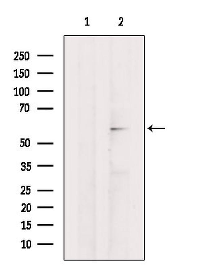 SNTB2 Antibody in Western Blot (WB)