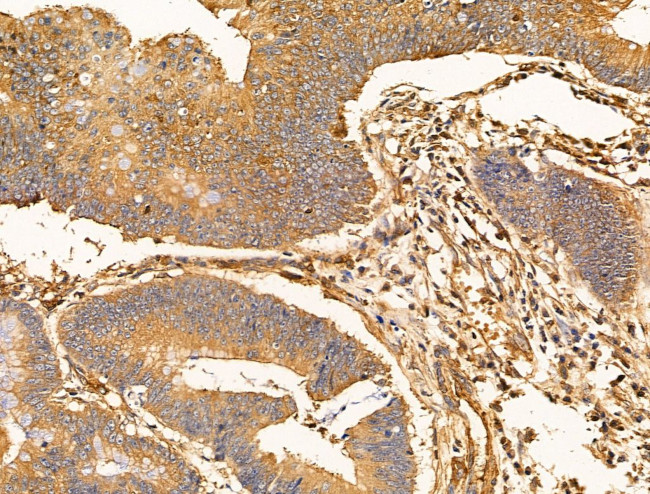 SNX6 Antibody in Immunohistochemistry (Paraffin) (IHC (P))