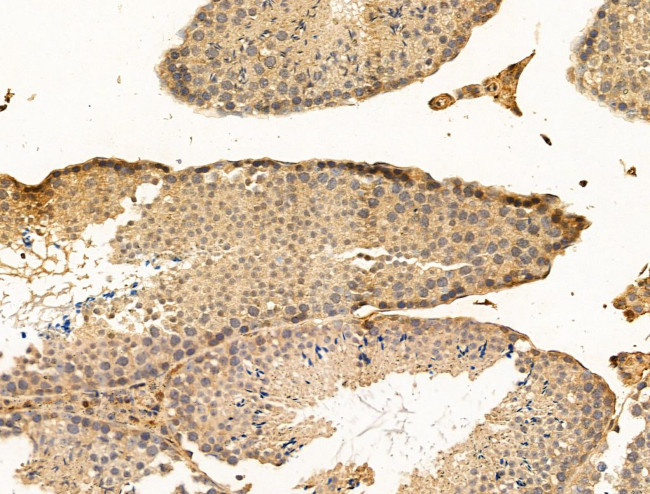 SNX6 Antibody in Immunohistochemistry (Paraffin) (IHC (P))