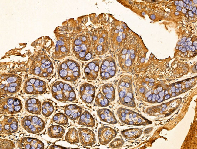 SNX6 Antibody in Immunohistochemistry (Paraffin) (IHC (P))