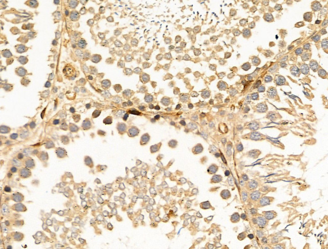 SNX6 Antibody in Immunohistochemistry (Paraffin) (IHC (P))