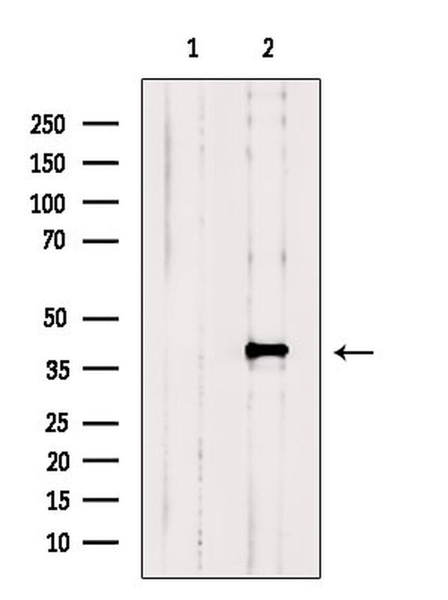 SNX6 Antibody in Western Blot (WB)