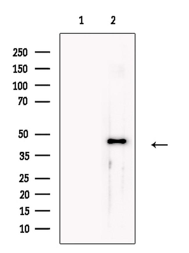 SNX6 Antibody in Western Blot (WB)