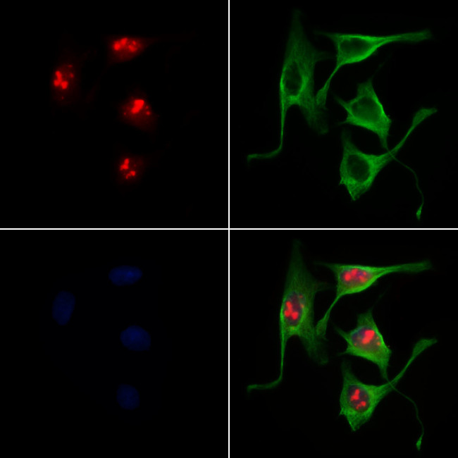 SOX11 Antibody in Immunocytochemistry (ICC/IF)