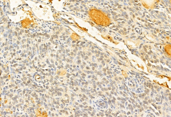 SOX9 Antibody in Immunohistochemistry (Paraffin) (IHC (P))