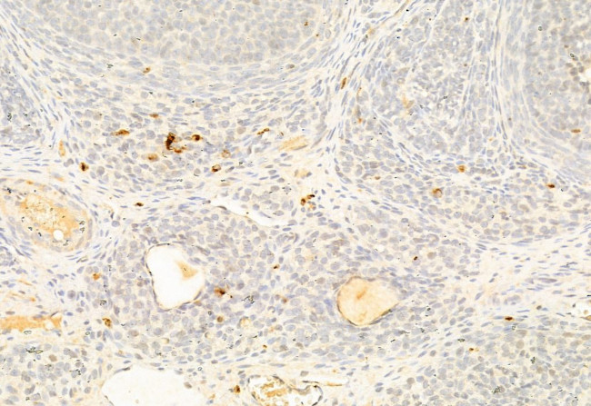 SOX9 Antibody in Immunohistochemistry (Paraffin) (IHC (P))