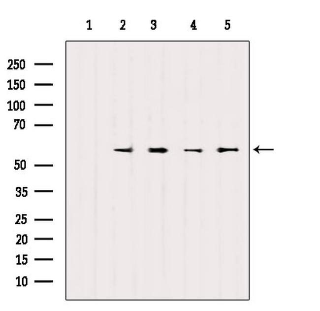 SOX9 Antibody in Western Blot (WB)