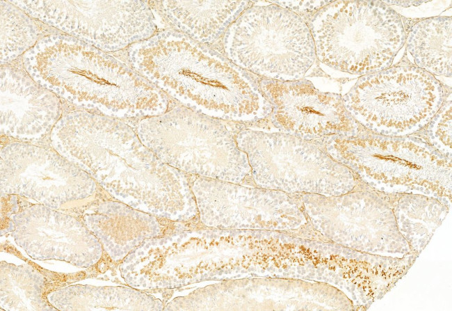 SP1 Antibody in Immunohistochemistry (Paraffin) (IHC (P))