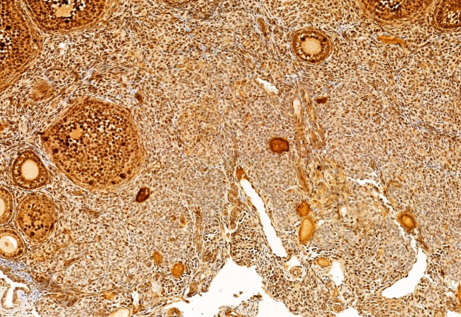 SP1 Antibody in Immunohistochemistry (Paraffin) (IHC (P))