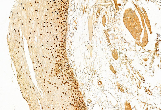 SP1 Antibody in Immunohistochemistry (Paraffin) (IHC (P))