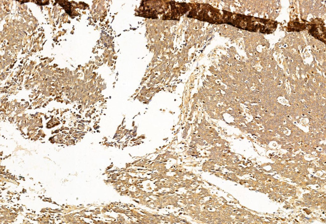 SP1 Antibody in Immunohistochemistry (Paraffin) (IHC (P))