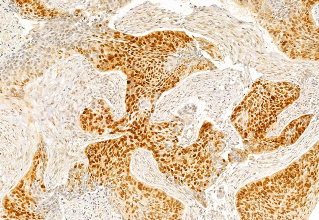 SP1 Antibody in Immunohistochemistry (Paraffin) (IHC (P))