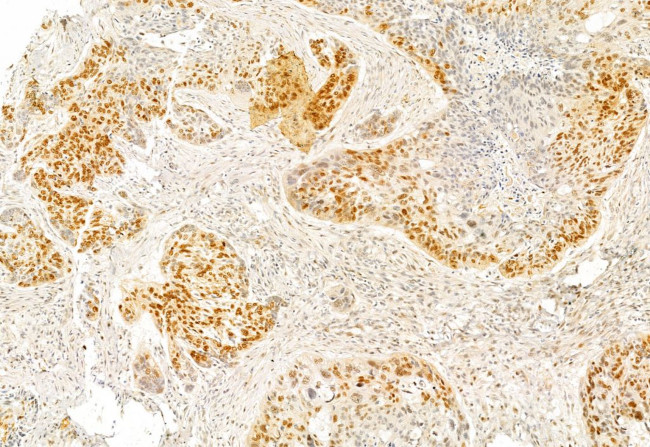 SP1 Antibody in Immunohistochemistry (Paraffin) (IHC (P))