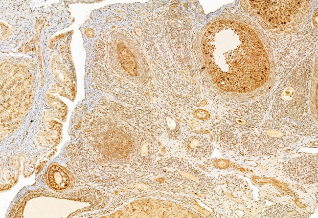 SP1 Antibody in Immunohistochemistry (Paraffin) (IHC (P))