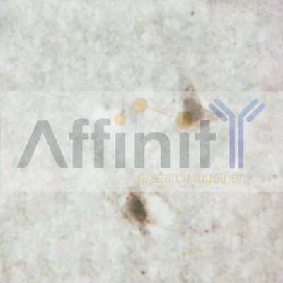 SP1 Antibody in Immunohistochemistry (Paraffin) (IHC (P))