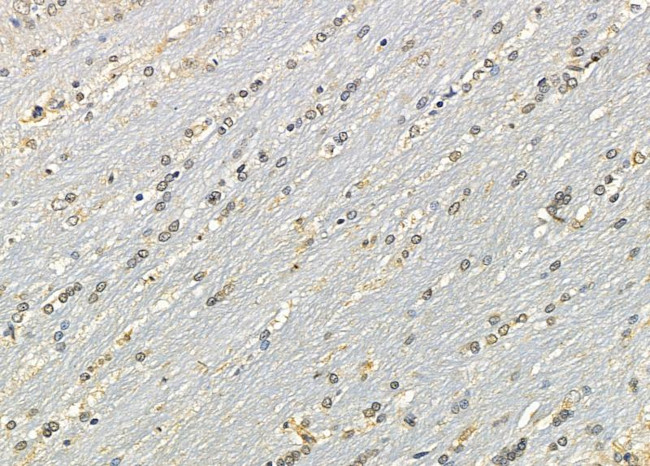 SP6 Antibody in Immunohistochemistry (Paraffin) (IHC (P))