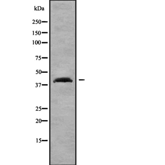 SP6 Antibody in Western Blot (WB)