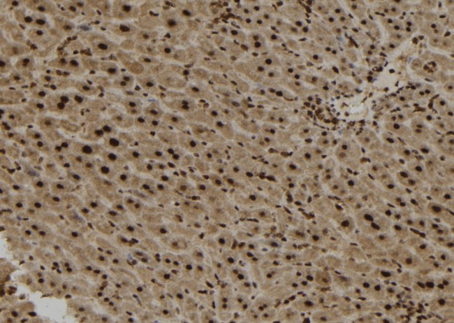 SPG11 Antibody in Immunohistochemistry (Paraffin) (IHC (P))