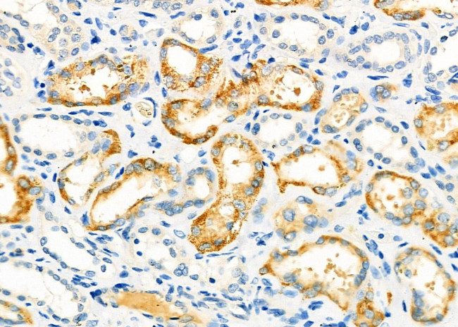 SPG11 Antibody in Immunohistochemistry (Paraffin) (IHC (P))