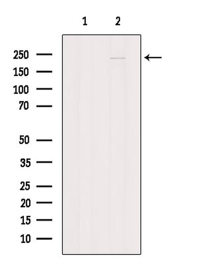 SPG11 Antibody in Western Blot (WB)