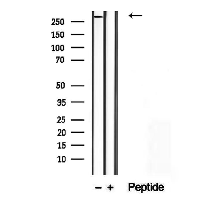 SPG11 Antibody in Western Blot (WB)