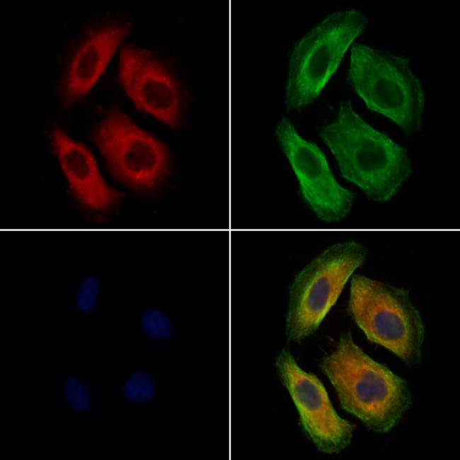 SPTLC1 Antibody in Immunocytochemistry (ICC/IF)