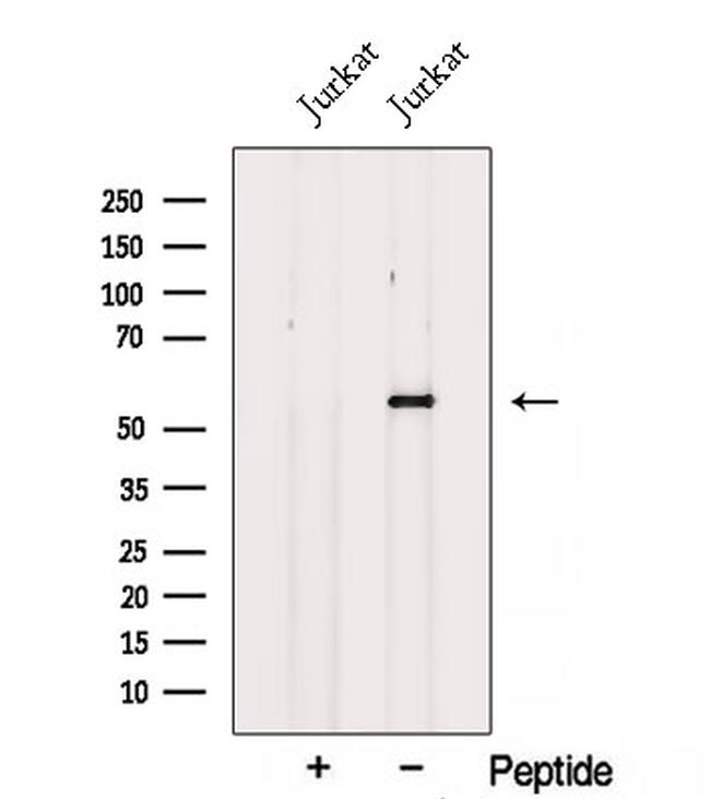 SPTLC1 Antibody in Western Blot (WB)