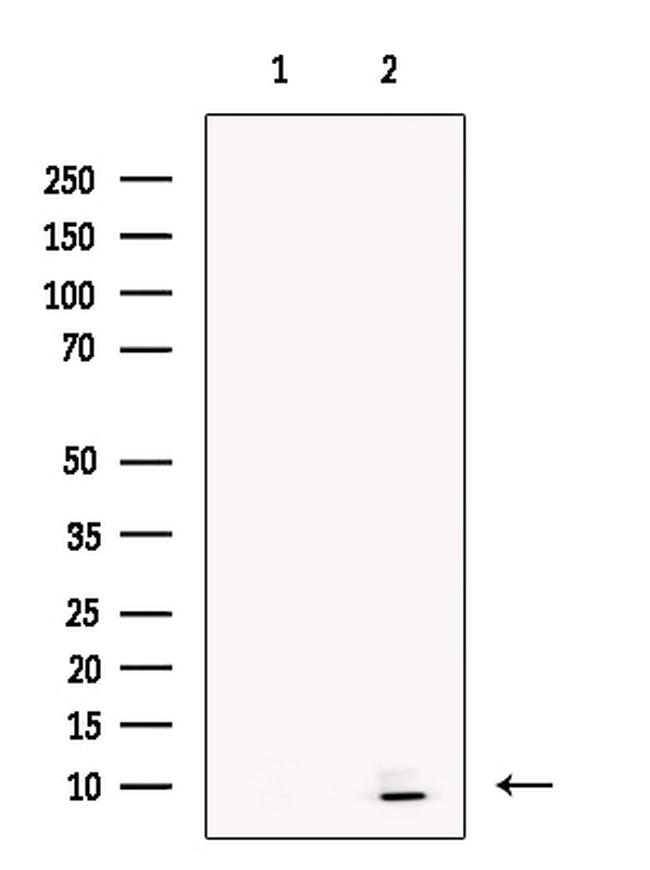 STATH Antibody in Western Blot (WB)