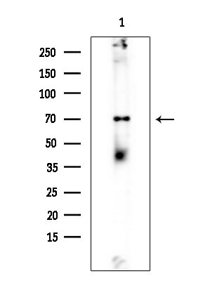 SPAK Antibody in Western Blot (WB)