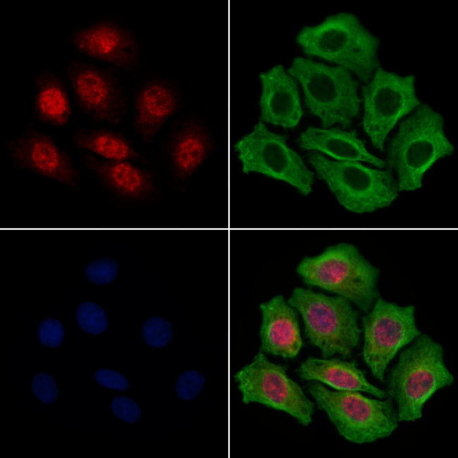 STS1 Antibody in Immunocytochemistry (ICC/IF)