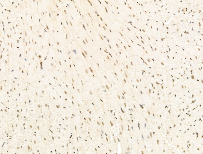 STS1 Antibody in Immunohistochemistry (Paraffin) (IHC (P))