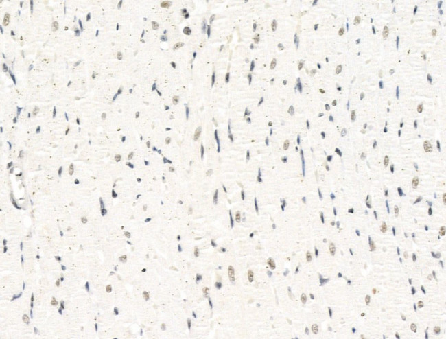 STS1 Antibody in Immunohistochemistry (Paraffin) (IHC (P))