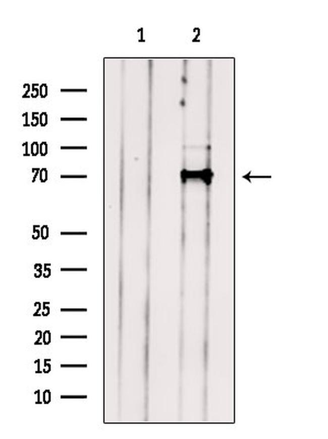 STS1 Antibody in Western Blot (WB)