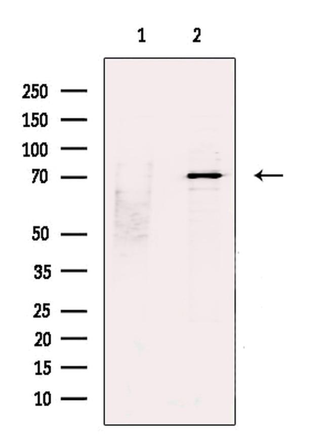 STS1 Antibody in Western Blot (WB)